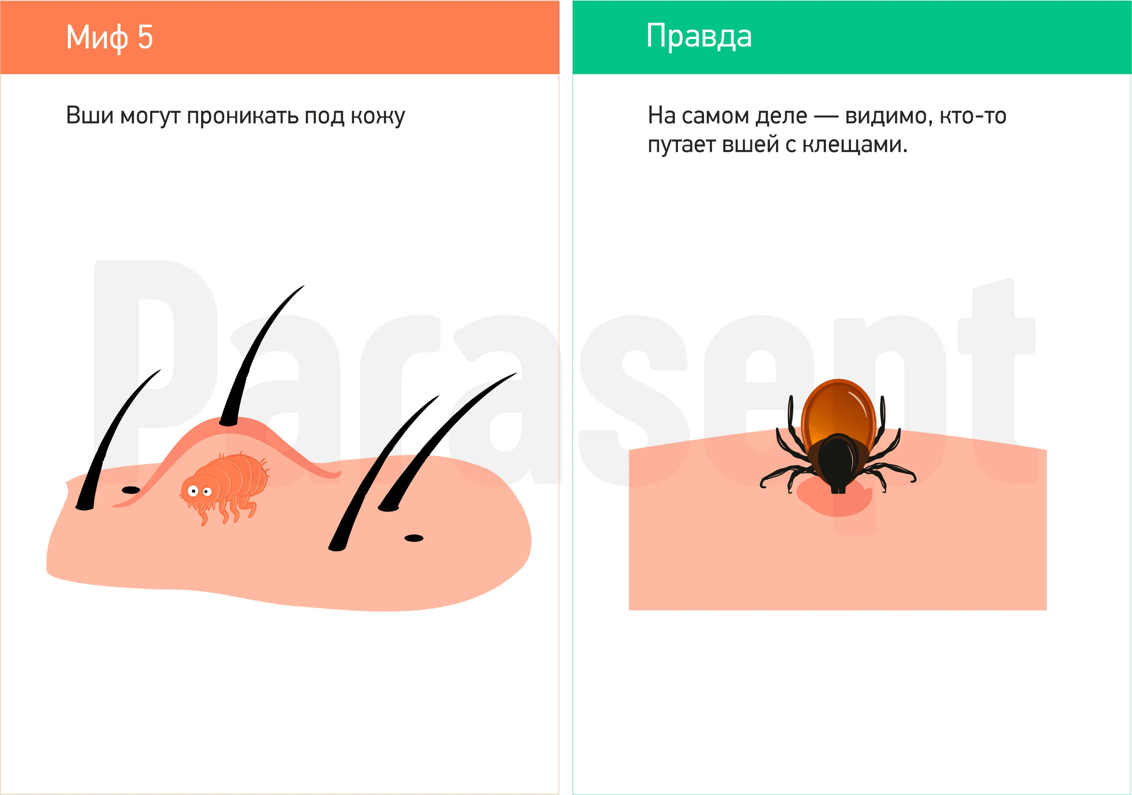 Миф о педикулезе