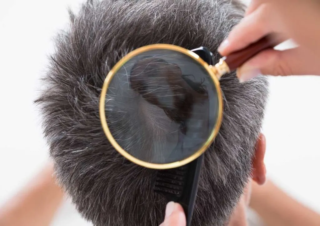 Фото – Осмотр волосистой части головы.